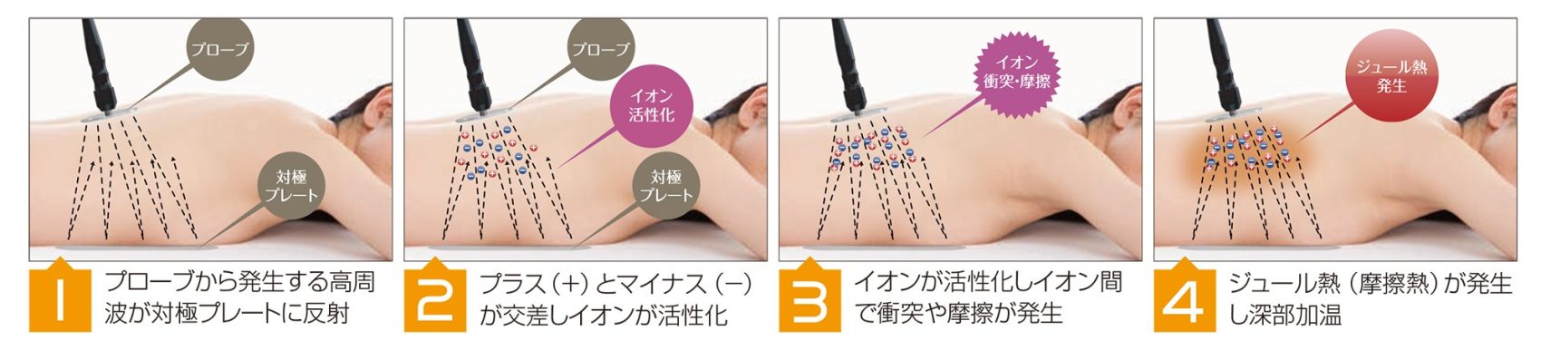 ラフォスの深部加温