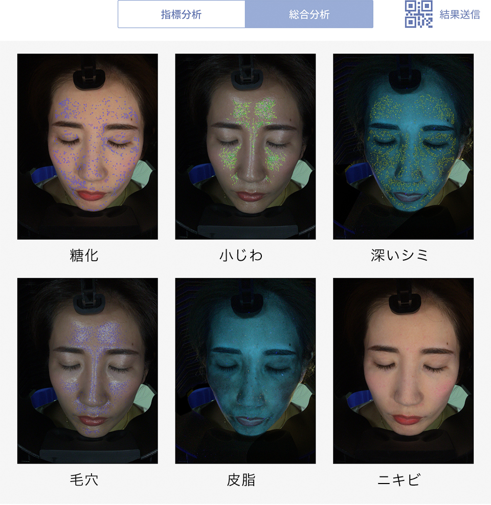 全体分析
