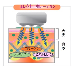 エレクトロポレーション