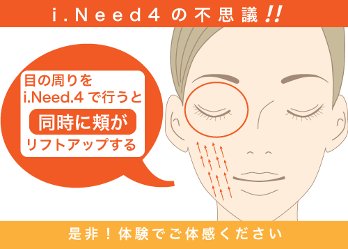 アイニード4