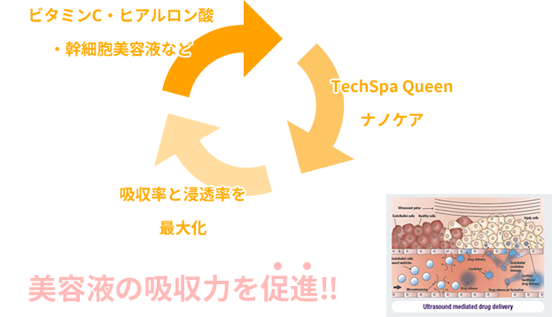 テクスパクイーン