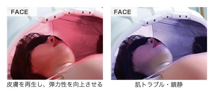 エステラックス