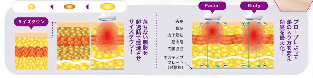 ラジオスター2