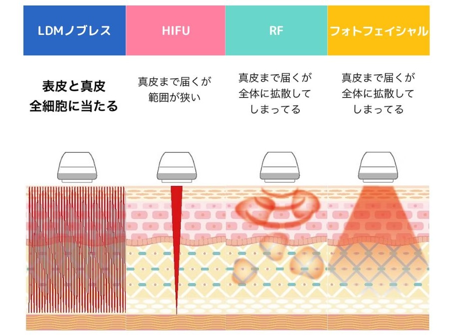高密度の振動エネルギーLDMテクスパ
