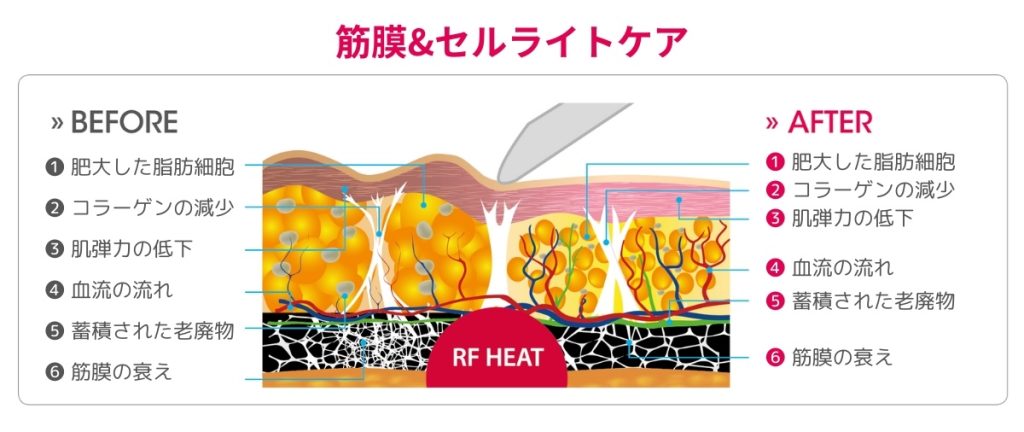 ファセラ（FASCELLA）