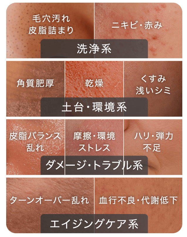 4種の要因｜ノーヴェリュクス