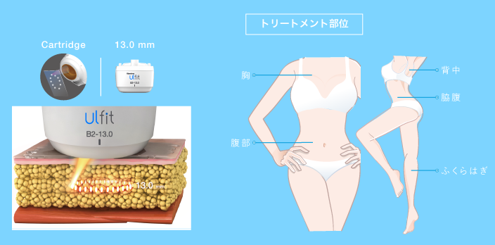ウルフィットボディトリートメント